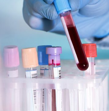 Анализ крови на ревмокомплекс в медицинской лаборатории IQlab