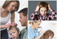 Лечение педикулеза у детей и взрослых