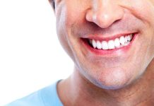 Уход за полостью рта после имплантации