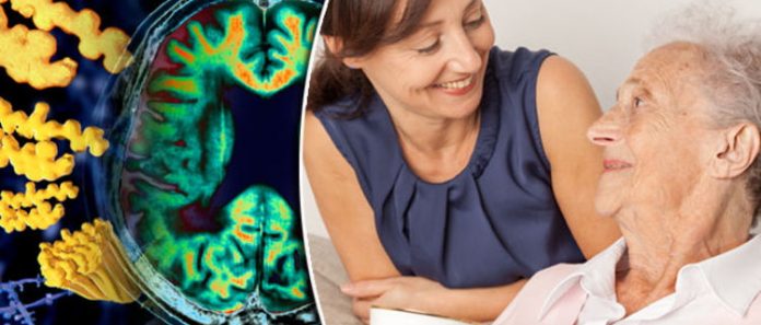 Первые симптомы болезни Альцгеймера