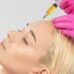 Плазмолифтинг лица: революционная PRP-терапия для красивой кожи