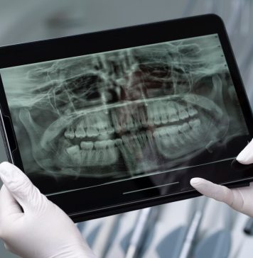 Снимок ОПТГ зубов: цена и необходимость