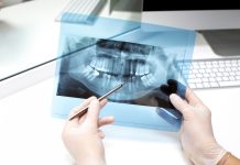 Диагностика зубов: Почему это важно и как проходит процесс