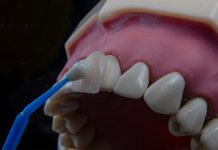 Керамические виниры: секрет идеальной улыбки без лишних хлопот