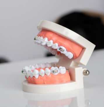 Циркониевые коронки: что это, зачем они нужны и как выбрать